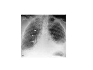 Acute Abdomen - Julie Cornish