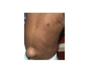 Acute Abdomen - Julie Cornish