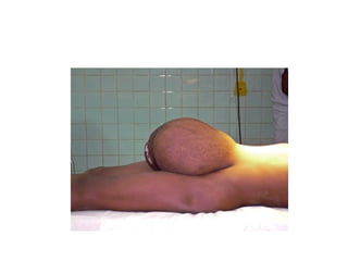 Acute Abdomen - Julie Cornish