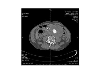 Acute Abdomen - Julie Cornish