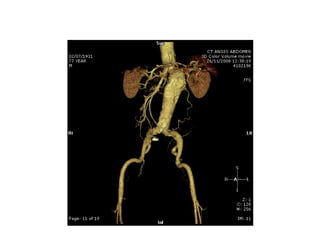 Acute Abdomen - Julie Cornish