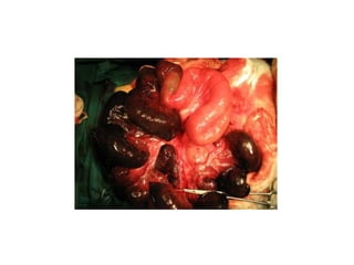 Acute Abdomen - Julie Cornish