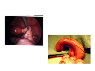 Acute Abdomen - Julie Cornish