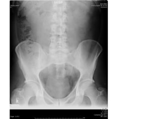Acute Abdomen - Julie Cornish