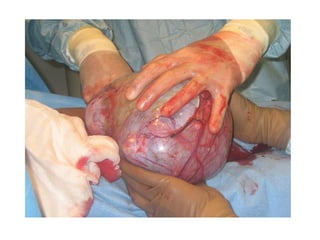 Acute Abdomen - Julie Cornish