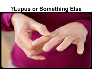 ?Lupus or Something Else
 