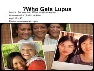 •
                 ?Who Gets Lupus
    Anyone , But more than 90% of people are women. :
•   African-American, Latino, or Asian
•   Aged 15 to 45
•   Related to someone with lupus
 