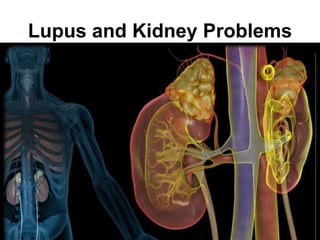 Lupus and Kidney Problems
 