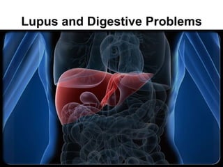 Lupus and Digestive Problems
 