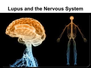Lupus and the Nervous System
 