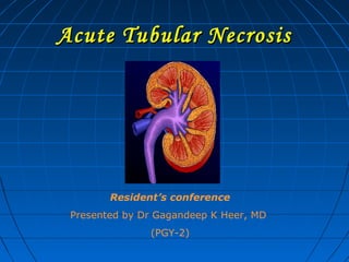 Acute Tubular NecrosisAcute Tubular Necrosis
Resident’s conference
Presented by Dr Gagandeep K Heer, MD
(PGY-2)
 