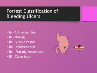 Acute_Ulcers_Erosions_Stomach_Presentation.pptx