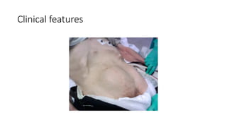 Clinical features
 