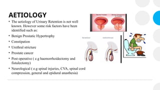 AETIOLOGY
• The aetiology of Urinary Retention is not well
known. However some risk factors have been
identified such as:
• Benign Prostatic Hypertrophy
• Constipation
• Urethral stricture
• Prostate cancer
• Post operative ( e.g haemorrhoidectomy and
fistulectomy)
• Neurological ( e.g spinal injuries, CVA, spinal cord
compression, general and epidural anasthesia)
 