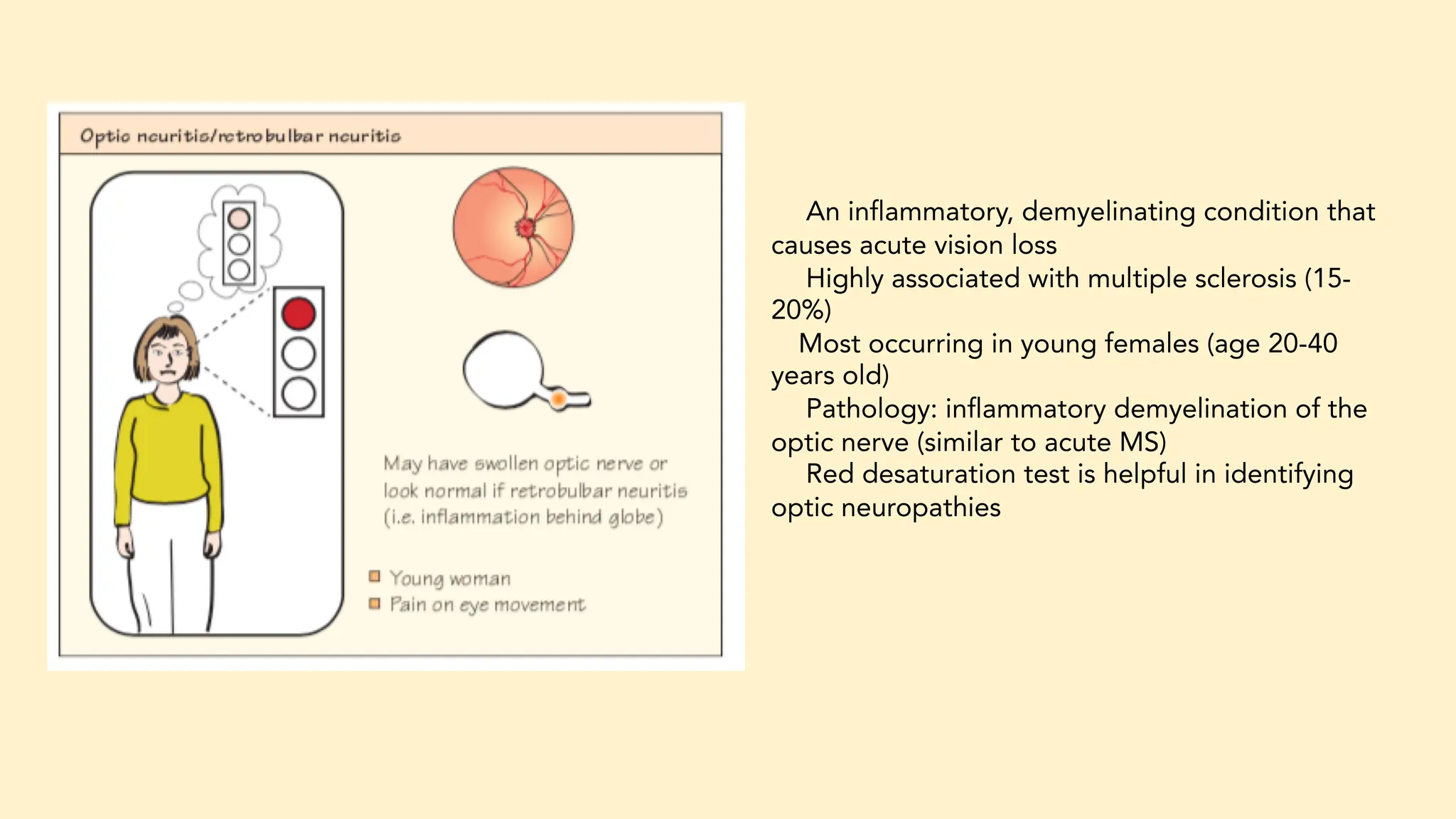 acute vision loss cme with case presentation 15022024 | PDF