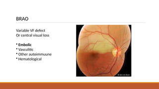 A PAINLESS ACUTE VISION LOSS - THE SILENT KILLER.pptx