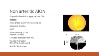 A PAINLESS ACUTE VISION LOSS - THE SILENT KILLER.pptx