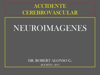 ACCIDENTE CEREBROVASCULAR NEUROIMAGENES DR. ROBERT ALONSO G. AGOSTO - 2011 