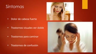Síntomas
• Dolor de cabeza fuerte
• Trastornos visuales ver doble
• Trastornos para caminar
• Trastornos de confusión
 
