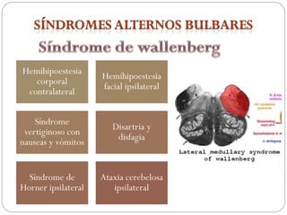 Hemihipoestesia
corporal
contralateral
Hemihipoestesia
facial ipsilateral
Síndrome
vertiginoso con
nauseas y vómitos
Disartria y
disfagia
Síndrome de
Horner ipsilateral
Ataxia cerebelosa
ipsilateral
 