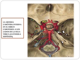 LA ARTERIA
CARÓTIDA INTERNA
EN EL SURCO
CAROTIDEO. A LOS
LADOS DE LA SILLA
TURCA (GLÁNDULA
HIPÓFISIS)
 