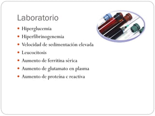Laboratorio
 Hiperglucemia
 Hiperfibrinogenemia
 Velocidad de sedimentación elevada
 Leucocitosis
 Aumento de ferritina sérica
 Aumento de glutamato en plasma
 Aumento de proteína c reactiva
 