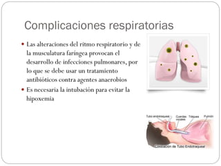 Complicaciones respiratorias
 Las alteraciones del ritmo respiratorio y de
la musculatura faríngea provocan el
desarrollo de infecciones pulmonares, por
lo que se debe usar un tratamiento
antibióticos contra agentes anaerobios
 Es necesaria la intubación para evitar la
hipoxemia
 