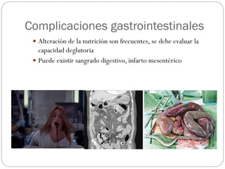 Complicaciones gastrointestinales
 Alteración de la nutrición son frecuentes, se debe evaluar la
capacidad deglutoria
 Puede existir sangrado digestivo, infarto mesentérico
 