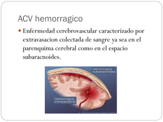 ACV hemorragico
 Enfermedad cerebrovascular caracterizado por
extravasacion colectada de sangre ya sea en el
parenquima cerebral como en el espacio
subaracnoides.
 