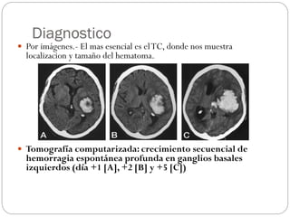 Diagnostico
 Por imágenes.- El mas esencial es elTC, donde nos muestra
localizacion y tamaño del hematoma.
 Tomografía computarizada: crecimiento secuencial de
hemorragia espontánea profunda en ganglios basales
izquierdos (día +1 [A], +2 [B] y +5 [C])
 