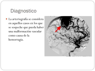 Diagnostico
 La arteriografía se considera
en aquellos casos en los que
se sospeche que pueda haber
una malformación vascular
como causa de la
hemorragia.
 