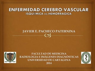JAVIER E. PACHECO PATERNINA
FACULTAD DE MEDICINA
RADIOLOGIA E IMÁGENES DIAGNÓSTICAS
UNIVERSIDAD DE CARTAGENA
2014
 