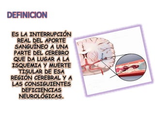 Acv | PPTX