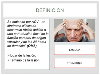 ACV | PPTX