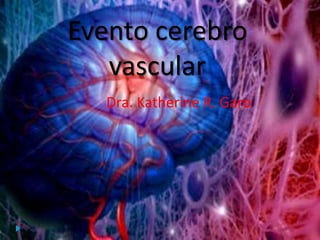 Dra. Katherine R. Garo
Evento cerebro
vascular
 