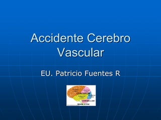 Accidente Cerebro
Vascular
EU. Patricio Fuentes R
 