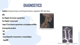 DIAGNOSTICO
Analítica: hemograma básico, perfil bioquímico básico, coagulación, VSG, electrolitos.
EKG
Eco-Doppler de troncos supraórtícos
Eco-doppler transcraneal
Angio-TC de troncos supraórticos o de polígono de Willis
TAC
RM
Ecocardiografía transtorócica y transesofógica
AngioRM
Arteriografía cerebral
 
