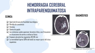 CLÍNICA
HEMORRAGIA CEREBRAL
INTRAPARENQUIMATOSA
 Aparición brusca de focalidad neurológica,
 Pérdida de conciencia
 Vómitos
 Edema de papila
 Los síntomas suelen aparecer durante el día y con frecuencia
en situaciones de estrés o esfuerzo físico.
 Empeora durante los siguientes 30-90 min
 La mortalidad (aprox 50% del total) es mayor que la del íctus
isquémico
DIAGNÓSTICO
 