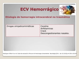 ECV Hemorrágico
Rodríguez-Yáñez M, et al. Guías de actuación clínica en la hemorragia intracerebral. Neurología.2011. doi:10.1016/j.nrl.2011.03.010
Etiología de hemorragia intracerebral no traumática
Drogas simpaticomiméticas Cocaína
Anfetaminas
Crack
Descongestionantes nasales.
 