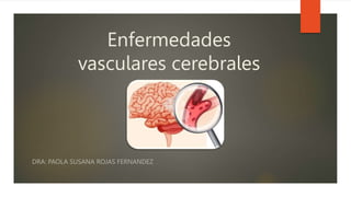 Enfermedades
vasculares cerebrales
DRA: PAOLA SUSANA ROJAS FERNANDEZ
 