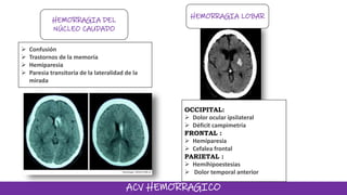 ACV HEMORRAGICO
HEMORRAGIA DEL
NÚCLEO CAUDADO
HEMORRAGIA LOBAR
 Confusión
 Trastornos de la memoria
 Hemiparesia
 Paresia transitoria de la lateralidad de la
mirada
OCCIPITAL:
 Dolor ocular ipsilateral
 Déficit campimetría
FRONTAL :
 Hemiparesia
 Cefalea frontal
PARIETAL :
 Hemihipoestesias
 Dolor temporal anterior
 
