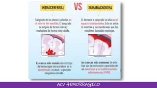 ACV HEMORRAGICO
 