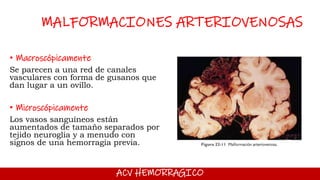 ACV HEMORRAGICO
MALFORMACIONES ARTERIOVENOSAS
• Macroscópicamente
Se parecen a una red de canales
vasculares con forma de gusanos que
dan lugar a un ovillo.
• Microscópicamente
Los vasos sanguíneos están
aumentados de tamaño separados por
tejido neuroglia y a menudo con
signos de una hemorragia previa.
 
