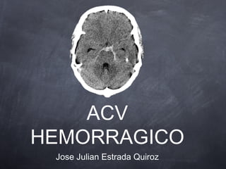 ACV
HEMORRAGICO
 Jose Julian Estrada Quiroz
 