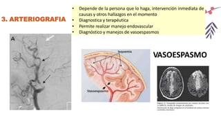 3. ARTERIOGRAFIA
• Depende de la persona que lo haga, intervención inmediata de
causas y otros hallazgos en el momento
• Diagnostica y terapéutica
• Permite realizar manejo endovascular
• Diagnóstico y manejos de vasoespasmos
VASOESPASMO
 