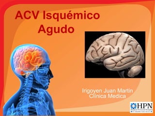 ACV Isquémico
Agudo
Irigoyen Juan Martin
Clínica Medica
 