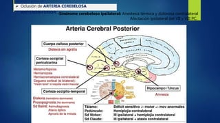  Oclusión de ARTERIA CEREBELOSA
ANTEROINFERIOR:-Síndrome cerebeloso ipsilateral: Anestesia térmica y dolorosa contralateral
Afectación ipsilateral del VII y VIII PC.
 