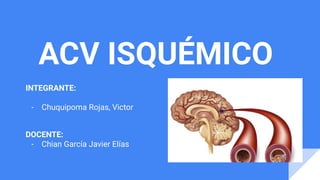 ACV ISQUÉMICO
INTEGRANTE:
- Chuquipoma Rojas, Victor
DOCENTE:
- Chian García Javier Elías
 