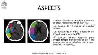 ASPECTS
-Lesiones hipodensas en alguna de esas
10 áreas resta un punto en la escala.
-Un puntaje de 10 implica un estudio
normal.
-Un puntaje de 0 indica afectación de
todo el territorio de la ACM.
-El puntaje mínimo aceptado para
ofrecer terapia trombolítica es de 7, un
puntaje menor se relaciona con menor
beneficio terapéutico.
Universitas Medica V. 60 No. 3 Jul-Sept 2019
 