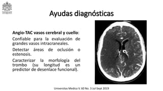 Ayudas diagnósticas
Angio-TAC vasos cerebral y cuello:
Confiable para la evaluación de
grandes vasos intracraneales.
Detectar áreas de oclusión o
estenosis.
Caracterizar la morfología del
trombo (su longitud es un
predictor de desenlace funcional).
Universitas Medica V. 60 No. 3 Jul-Sept 2019
 